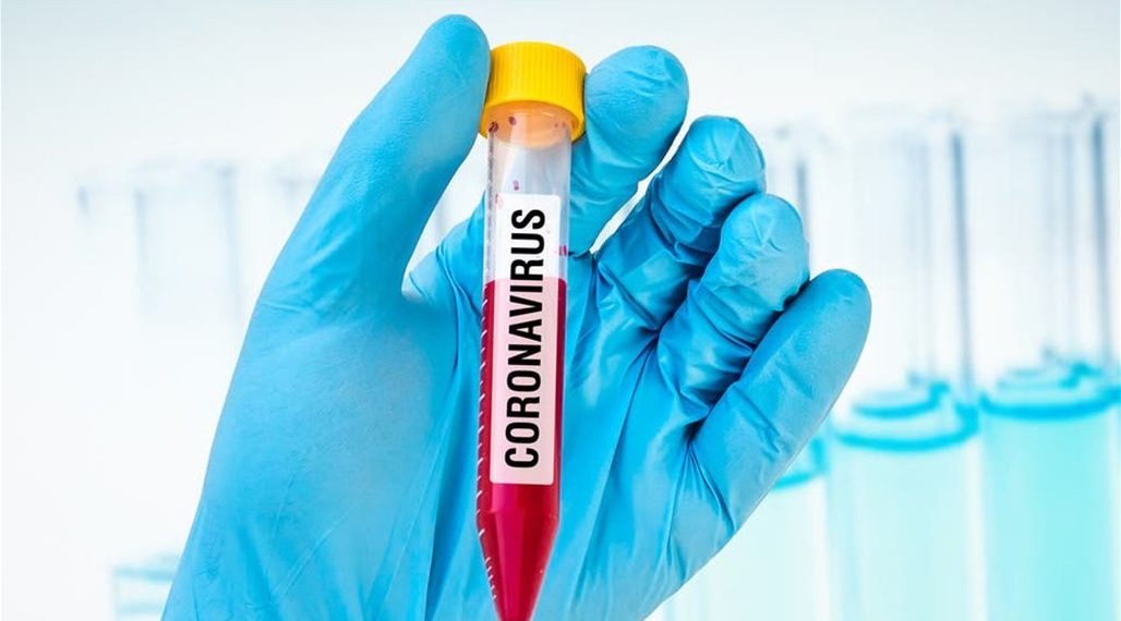 صحة النجف تعلن وفاة احد المصابين بكورونا